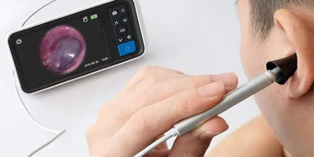 Die 5 besten Ohrenschmalzentferner für das Jahr 2024 – Artikel Vergleichen